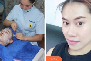 運(yùn)城海鷗美容外科診所程?hào)|海整形價(jià)格表附微針?biāo)獍咐故?>
</a>
<h3 class=