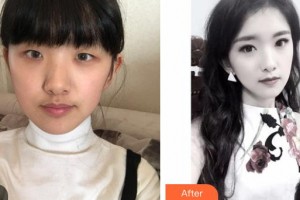 運(yùn)城市眼科醫(yī)院曲驗(yàn)兵整形價格表附激光去眼袋案例展示