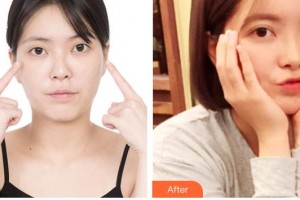 運(yùn)城愛(ài)爾眼科醫(yī)院姜?jiǎng)φ蝺r(jià)格表附開(kāi)內(nèi)眼角案例展示