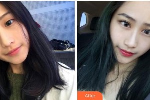 運(yùn)城市眼科醫(yī)院武廣智整形價(jià)格表附切開(kāi)雙眼皮案例展示