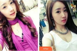 臨汾憶佳星醫(yī)療美容門診部楚向杰整形價(jià)格表附鼻部綜合案例展示