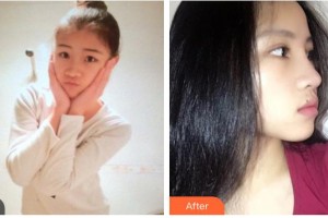 臨汾市堯都區(qū)眼科醫(yī)院樊靜住院醫(yī)師整形價(jià)格表附鼻部綜合案例展示