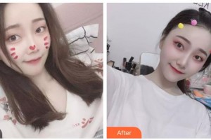 內(nèi)蒙古林業(yè)總醫(yī)院燒傷整形科姚荔湘整形價(jià)格表附紅藍(lán)光祛痘案例展示