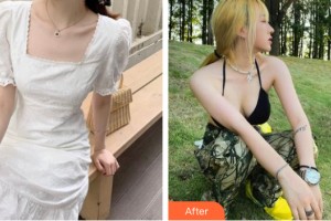 南昌愛思特醫(yī)療美容醫(yī)院劉健整形價格表附隆胸手術(shù)案例展示