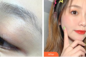 南昌美伊爾醫(yī)療美容門診部易婷婷 整形價(jià)格表附紋眉案例展示