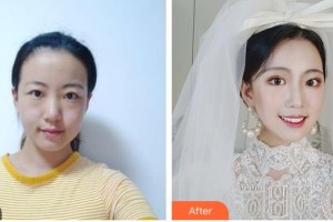 呼和浩特任榮大韓醫(yī)療美容診所張高貴整形價格表附眼部綜合案例展示