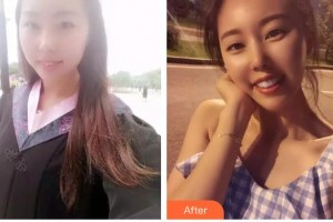 呼和浩特董志新口腔門診部張建明整形價格表附牙齒陶瓷矯正案例展示