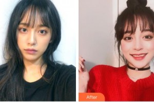 包頭伽藍(lán)（原巴諾巴奇)醫(yī)療美容醫(yī)院王林琳整形價格表附光子嫩膚例展示