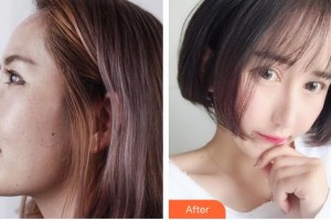 赤峰康華皮膚病醫(yī)院劉星赫整形價格表附鼻部綜合案例展示