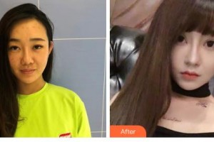 吉林銘醫(yī)整形美容醫(yī)院姜麗整形價(jià)格表附無針?biāo)獍咐故?>
</a>
<h3 class=