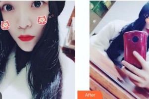 吉林銘醫(yī)整形美容醫(yī)院邵仁玲整形價(jià)格表附微針?biāo)獍咐故?>
</a>
<h3 class=