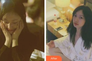 吉林省公安邊防總隊醫(yī)院醫(yī)整形美容中心李萬同整形價格表附激光祛斑案例展示