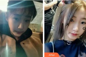 吉林中妍整形美容醫(yī)院馬速里整形價(jià)格表附光子嫩膚案例展示