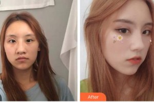 長春韓一美容醫(yī)院金載旭整形價格表附鼻部綜合案例展示
