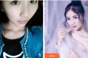 長春愛麗醫(yī)療美容門診部華淑麗整形價格表附眼部綜合案例展示