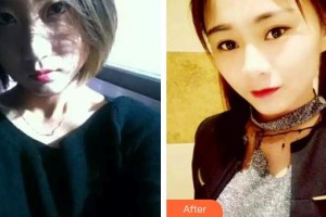 長春奧拉克美容醫(yī)院金相勛整形價格表附激光祛斑案例展示