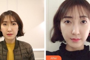 長春瑞爾麗整形美容門診部姜宗和整形價格表附超聲提拉案例展示