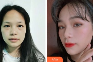 南昌同濟(jì)美容醫(yī)院黃慶良整形價(jià)格表附皮膚美容案例展示