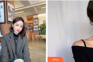 佳木斯銘源皇宮醫(yī)療美容門診部孫丹整形價格表附皮膚美容案例展示