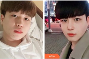 遼源張慶國(guó)醫(yī)療美容診所張慶國(guó)整形價(jià)格表附鼻部綜合案例展示