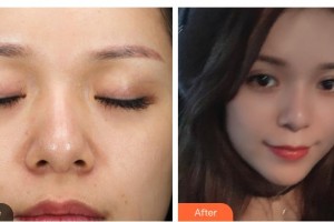 白城春俏美容整形醫(yī)院許鐵焰整形價(jià)格表附熱拉提案例展示