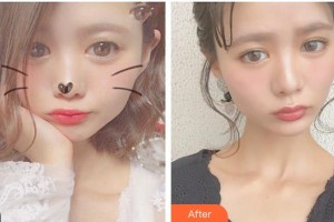 陜西省第二人民醫(yī)院眼科傅鋼整形價格表附眼部綜合案例展示