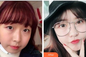 寶雞韓美醫(yī)療美容門診部苗一鳴整形價格表附牙齒隱形矯正案例展示