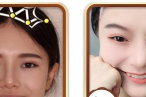 寶雞愛爾眼科醫(yī)院王明利整形價格表附牙齒隱形矯正案例展示