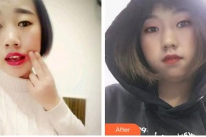 寶雞市口腔醫(yī)院姚貴良整形價格表附根管調(diào)節(jié)案例展示