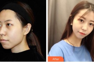 常熟金山整形美容門診部萬(wàn)衛(wèi)東整形價(jià)格表附光子嫩膚案例展示