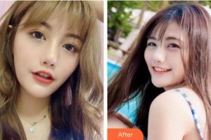 貴州歐貝頤醫(yī)療整形醫(yī)院宋輝整形價格表附激光祛斑案例展示