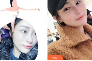 遵義韓美整形美容醫(yī)院彭全明整形價(jià)格表附激光美膚激光案例展示