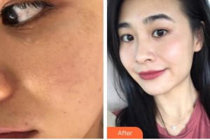 遵義韓美整形美容醫(yī)院王軍整形價格表附光子嫩膚案例展示