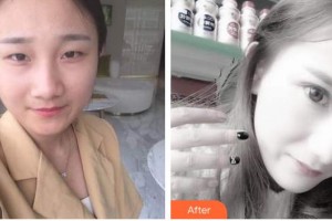 銅仁仁愛眼科醫(yī)院鄧西鐵整形價(jià)格表附眼部綜合案例展示