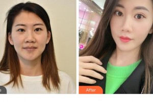 銅仁仁愛眼科醫(yī)院諶雅琦整形價(jià)格表附眼部修復(fù)案例展示