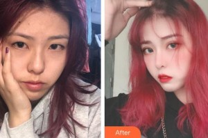 銅仁仁愛眼科醫(yī)院張曉承整形價(jià)格表附眼部綜合案例展示