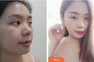 張家港唯恩醫(yī)療美容醫(yī)院陳天杰整形價(jià)格表附無針?biāo)獍咐故?>
</a>
<h3 class=