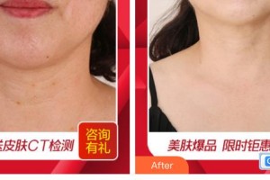 廣西東方整形美容醫(yī)院徐國建整形價(jià)格表附祛疤痕案例展示