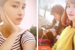 廣西中醫(yī)藥大學(xué)附屬瑞康醫(yī)院整形美容中心高靜整形價(jià)格表附美白劑美白牙齒案例展示