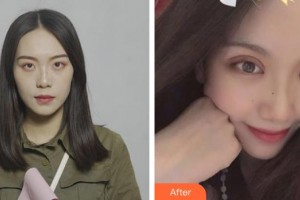 貴港愛(ài)爾眼科醫(yī)院梁岸整形價(jià)格表附眼部綜合案例展示