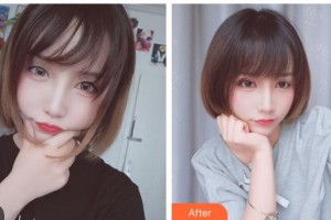 玉林愛(ài)爾眼科醫(yī)院劉偉民整形價(jià)格表附切開(kāi)雙眼皮案例展示