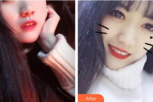 江陰牙博士口腔門診部蔡正飛整形價(jià)格表附美白劑美白牙齒案例展示