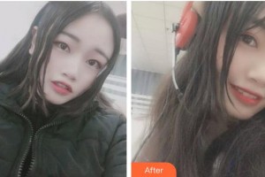 ?？诤佳谰S信口腔門診部方略宇整形價格表附牙齒隱形矯正案例展示