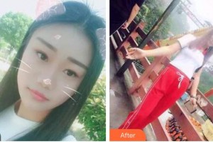 ?？谕？谇婚T診部陳新整形價格表附美白貼片案例展示