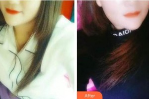 海口馬華祥口腔門診部馬華祥整形價格表附牙齒隱形矯正案例展示