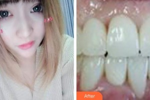 ?？诘露骺谇婚T診部喬磊整形價格表附超聲波潔牙案例展示