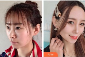 ?？诩t妝尚醫(yī)療美容門診部吳健整形價格表附眼部綜合案例展示