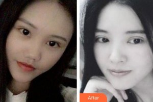 ?？诩t妝尚醫(yī)療美容門診部趙麗萍整形價格表附眼部綜合案例展示