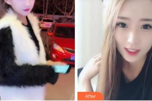 揚州貝恩口腔醫(yī)院張必安整形價格表附牙齒隱形矯正案例展示