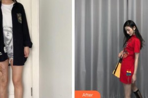 荊州市第二人民醫(yī)院整形激光美容中心謝磊整形價(jià)格表附微創(chuàng)疤痕修復(fù)案例展示